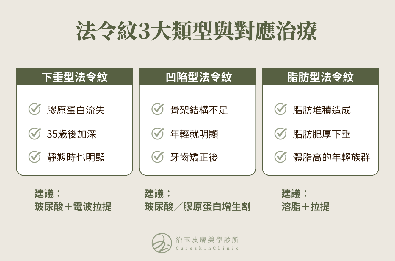 認識3種法令紋類型