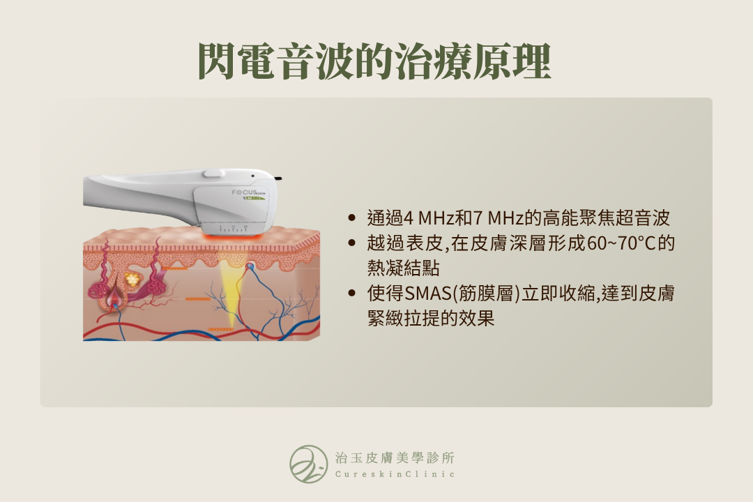 閃電音波的治療原理