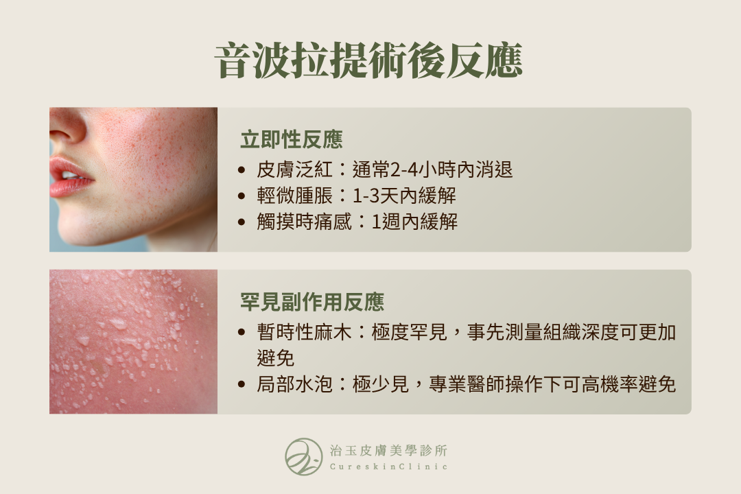 音波拉提術後反應